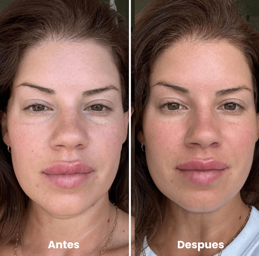 Zenova™ Rodillo de Hielo Facial