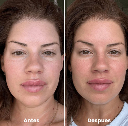 Zenova™ Rodillo de Hielo Facial